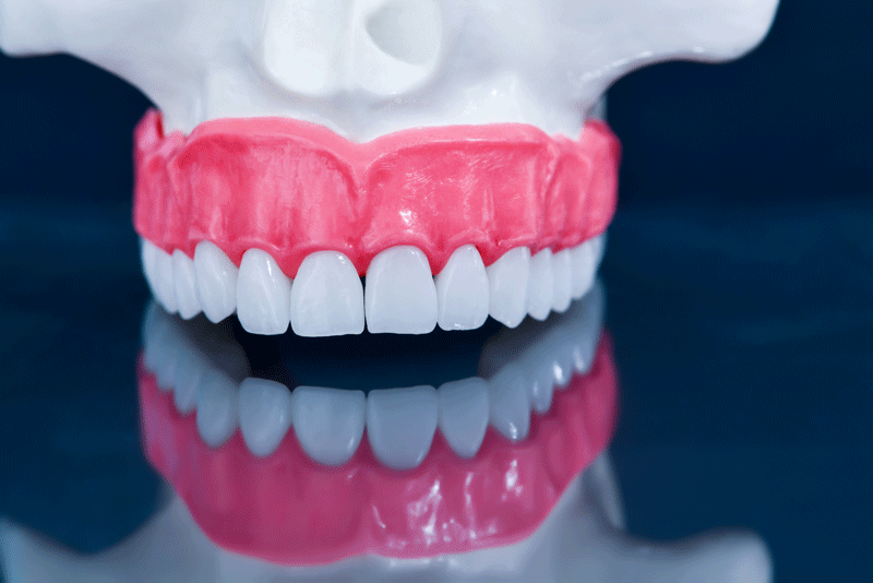 Teeth Model Showing An Implant / Dental Demonstration Teeth Study Teach Model On White Background Image551133460
